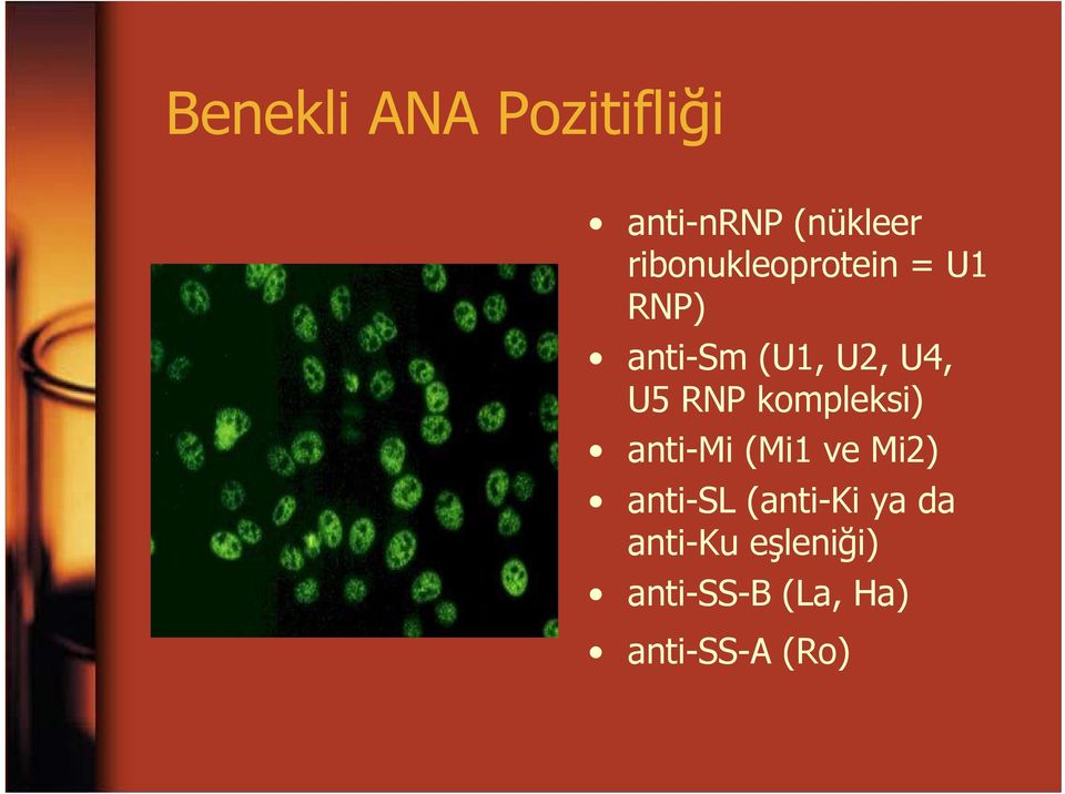 RNP kompleksi) anti-mi (Mi1 ve Mi2) anti-sl