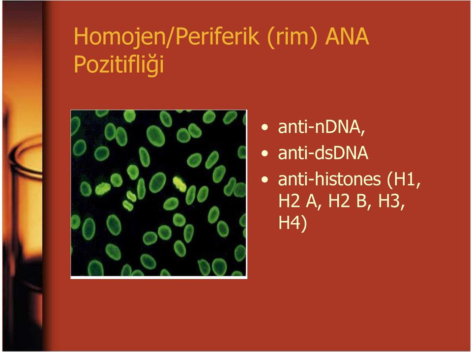 anti-ndna, anti-dsdna