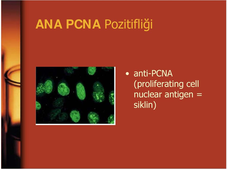 anti-pcna