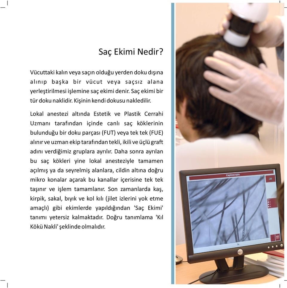 Lokal anestezi altında Estetik ve Plastik Cerrahi Uzmanı tarafından içinde canlı saç köklerinin bulunduğu bir doku parçası (FUT) veya tek tek (FUE) alınır ve uzman ekip tarafından tekli, ikili ve
