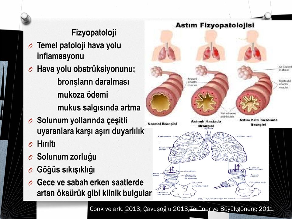 aşırı duyarlılık Hırıltı Solunum zorluğu Göğüs sıkışıklığı Gece ve sabah erken saatlerde