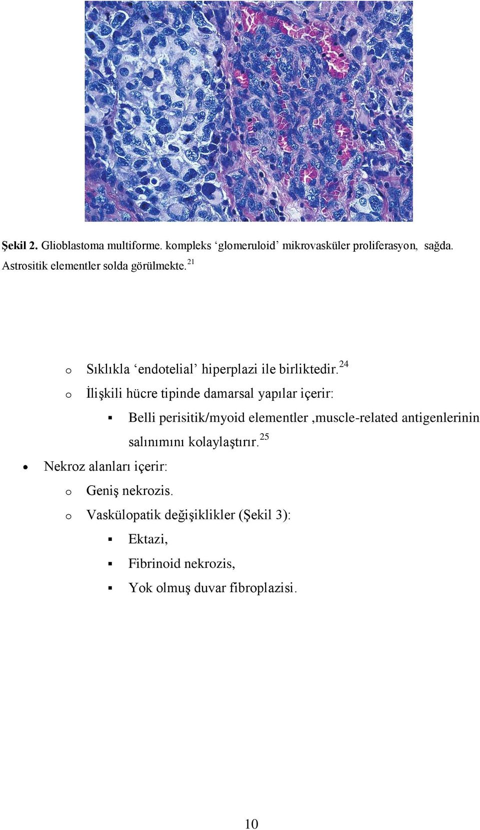 24 o İlişkili hücre tipinde damarsal yapılar içerir: Belli perisitik/myoid elementler,muscle-related antigenlerinin