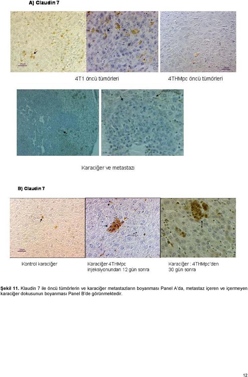 metastazların boyanması Panel A da,