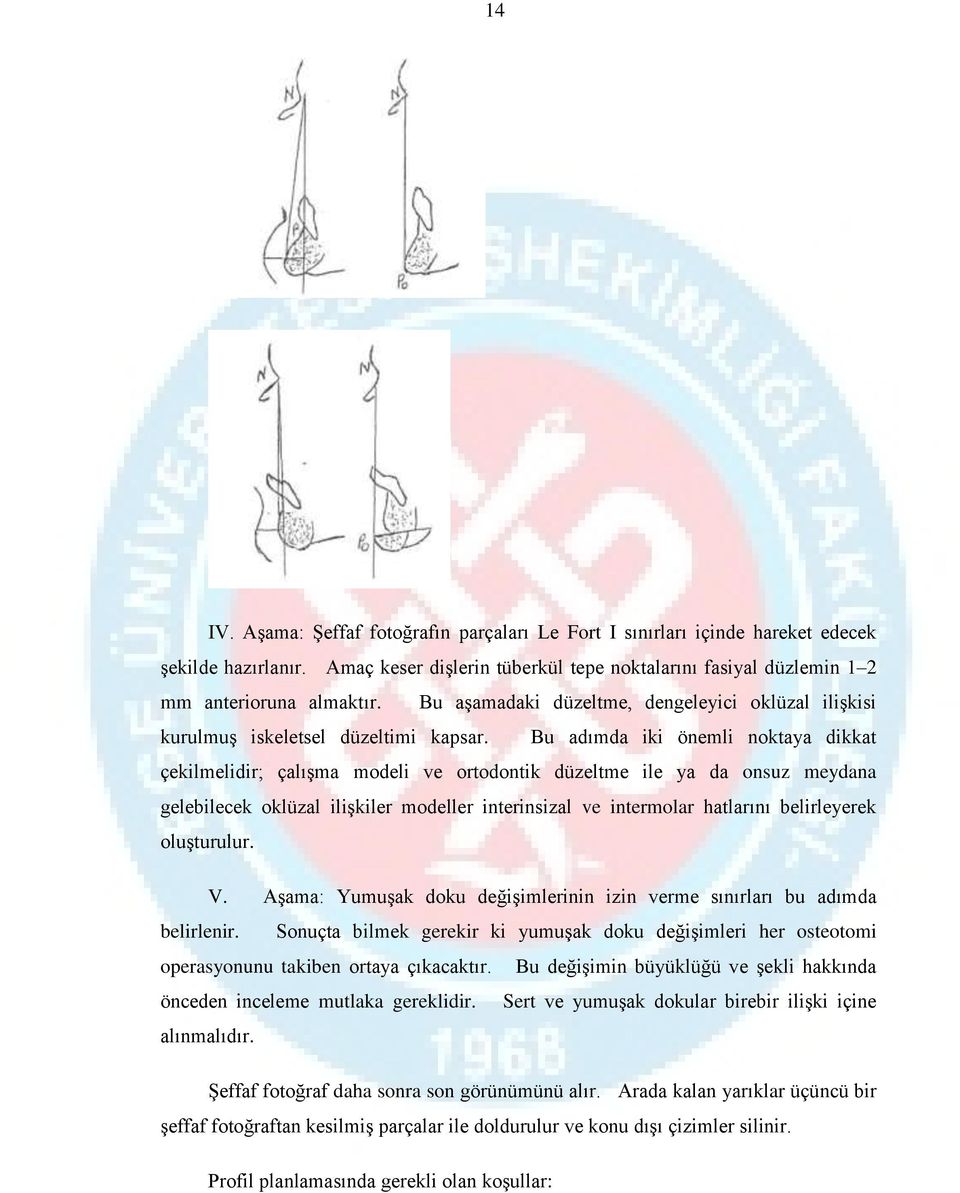 Bu adımda iki önemli noktaya dikkat çekilmelidir; çalışma modeli ve ortodontik düzeltme ile ya da onsuz meydana gelebilecek oklüzal ilişkiler modeller interinsizal ve intermolar hatlarını