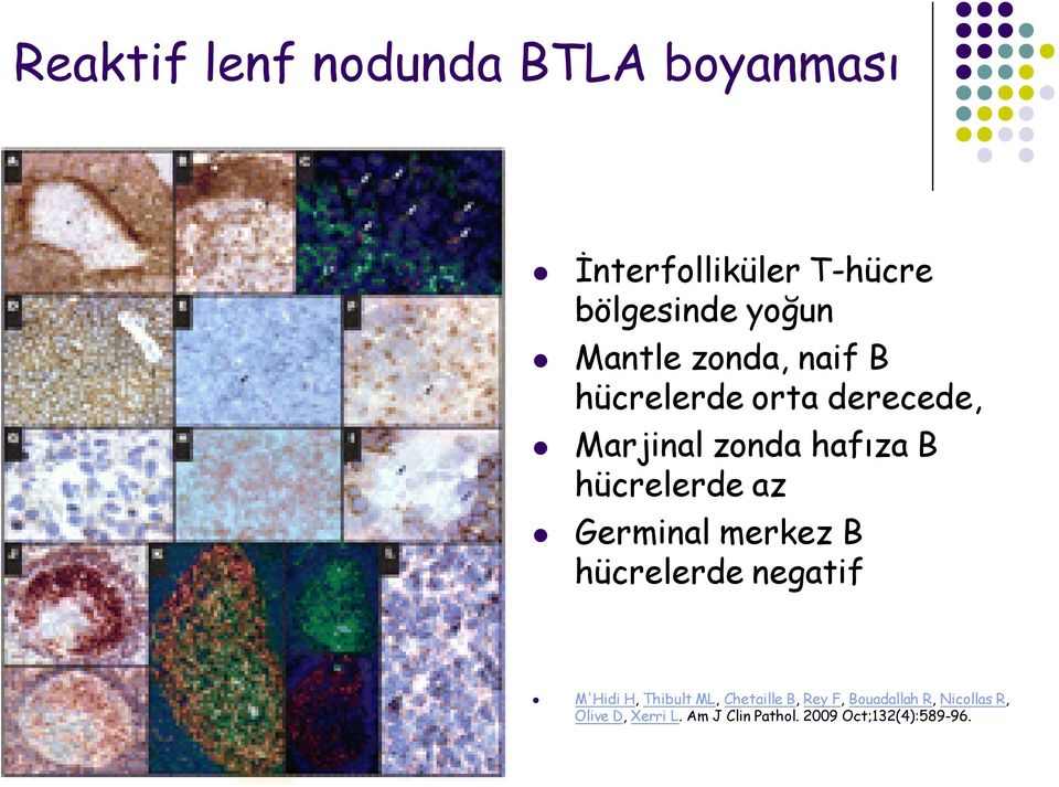 az Germinal merkez B hücrelerde negatif M'Hidi H, Thibult ML, Chetaille B, Rey F,