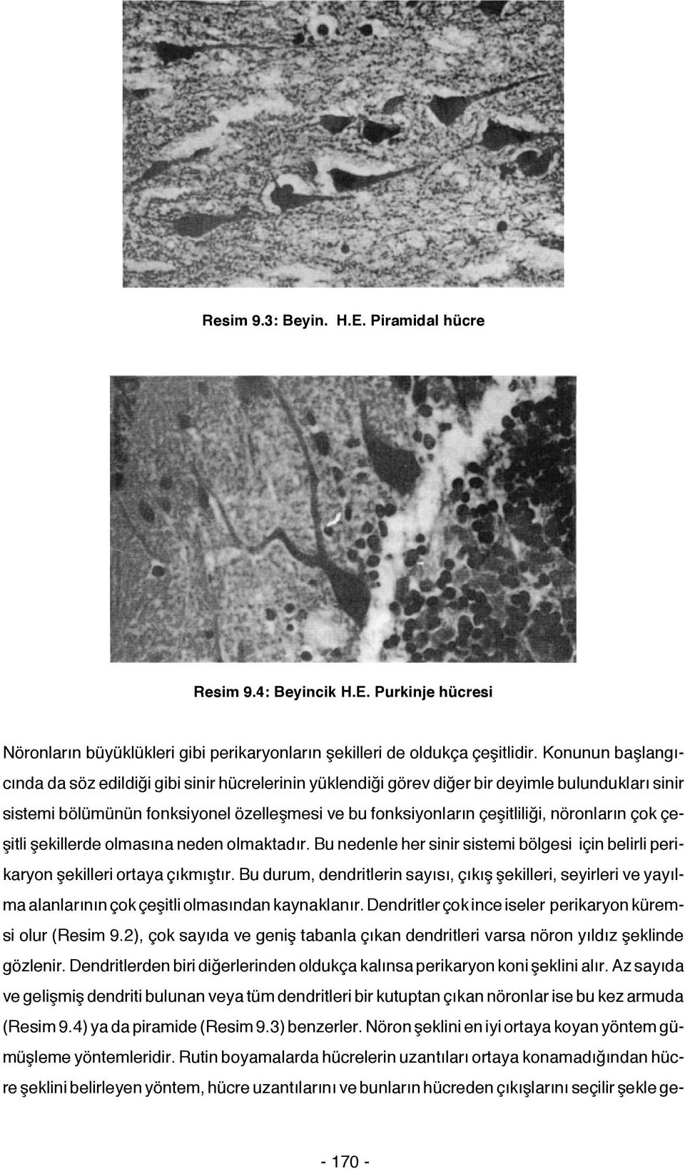 nöronların çok çeşitli şekillerde olmasına neden olmaktadır. Bu nedenle her sinir sistemi bölgesi için belirli perikaryon şekilleri ortaya çıkmıştır.