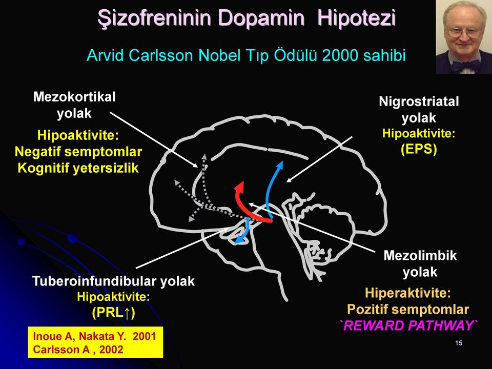 Hipoaktivite: (EPS) Tuberoinfundibular yolak Hipoaktivite: (PRL ) Inoue A, Nakata Y.