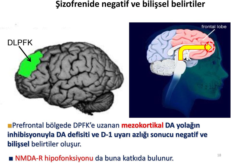 DA defisiti ve D-1 uyarı azlığı sonucu negatif ve bilişsel