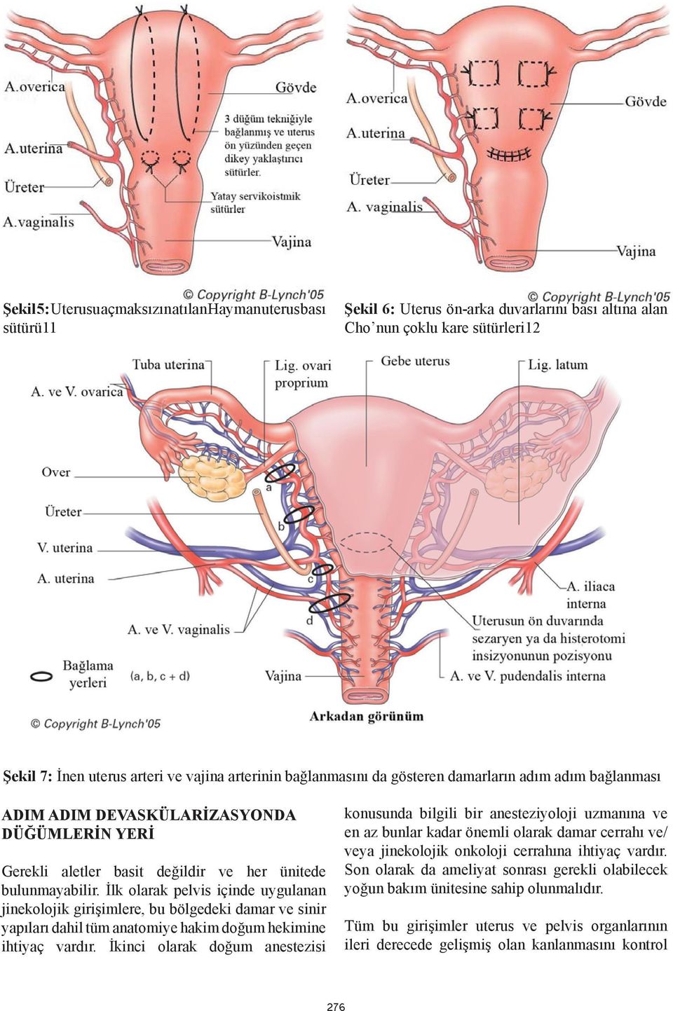 İlk olarak pelvis içinde uygulanan jinekolojik girişimlere, bu bölgedeki damar ve sinir yapıları dahil tüm anatomiye hakim doğum hekimine ihtiyaç vardır.