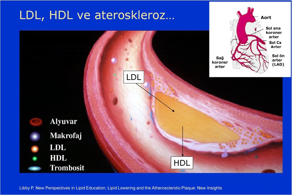 HDL Libby P, New Perspectives in Lipid Education,