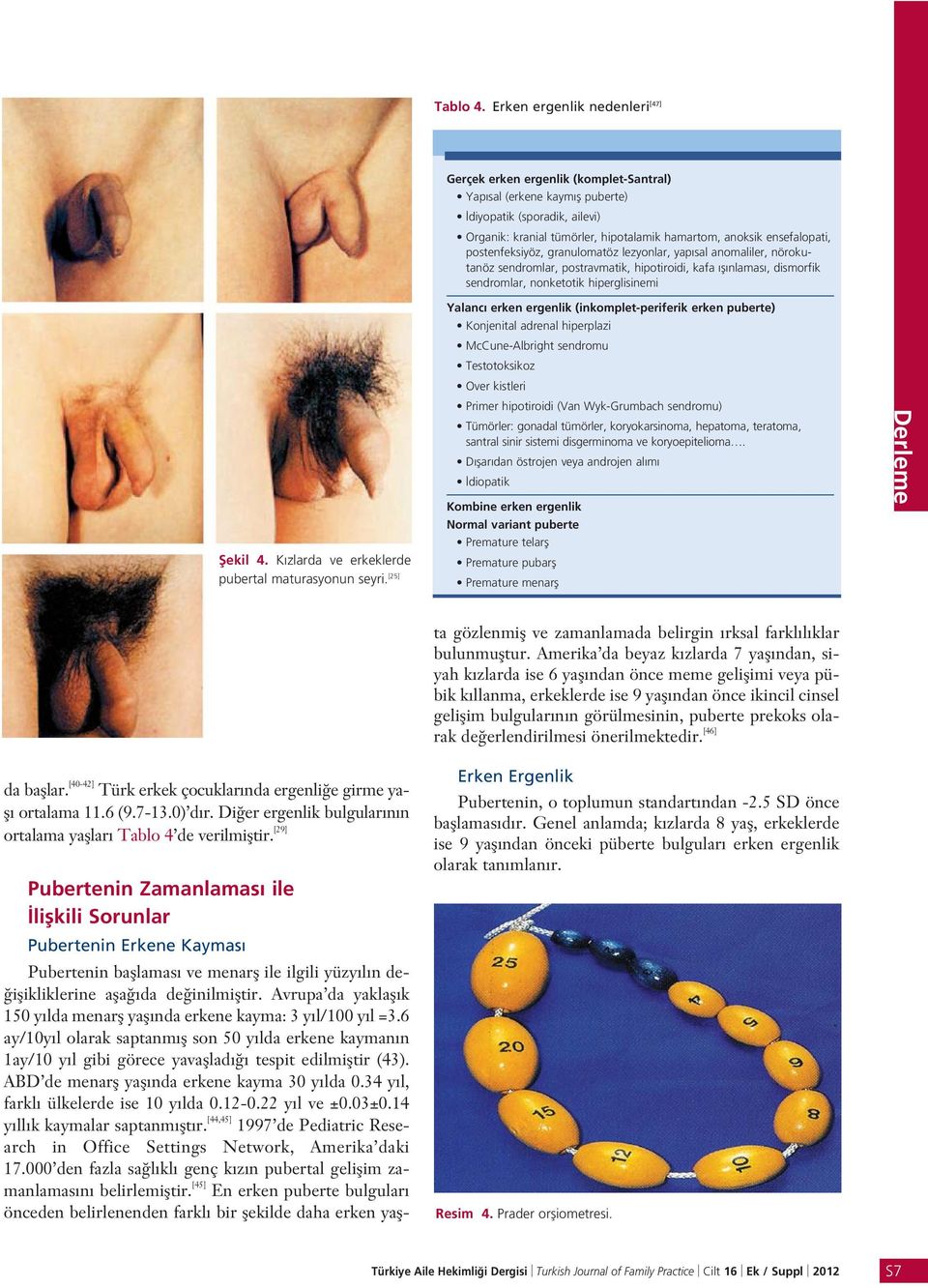 ensefalopati, postenfeksiyöz, granulomatöz lezyonlar, yap sal anomaliler, nörokutanöz sendromlar, postravmatik, hipotiroidi, kafa fl nlamas, dismorfik sendromlar, nonketotik hiperglisinemi fiekil 4.