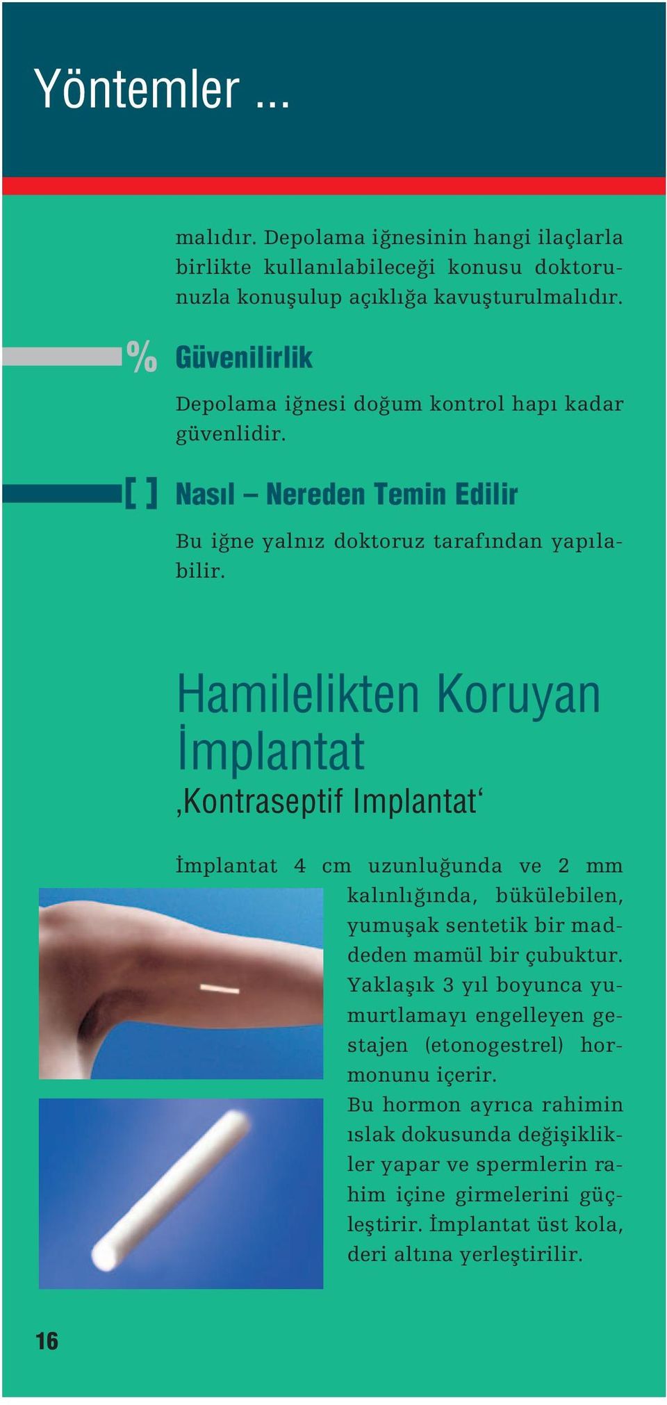 Hamilelikten Koruyan #mplantat Kontraseptif Implantat #mplantat 4 cm uzunlu unda ve 2 mm kalınlı ında, bükülebilen, yumuƒak sentetik bir maddeden mamül bir çubuktur.