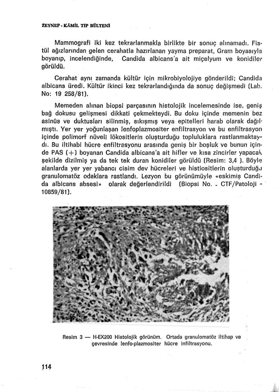 zamanda kültür için mikrobiyolojiye gönderildi: Candida albicans üredi. Kültür ikinci kez tekrarlandığında da sonuç değişmedi (Lab. No: 19 258/81).
