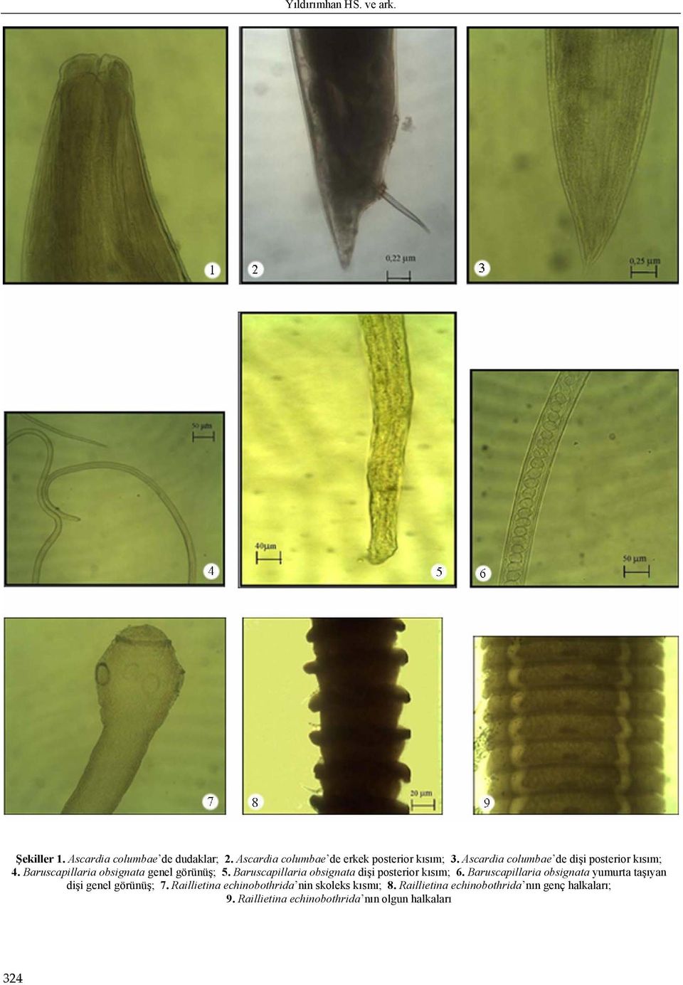 Baruscapillaria obsignata dişi posterior kısım; 6. Baruscapillaria obsignata yumurta taşıyan dişi genel görünüş; 7.