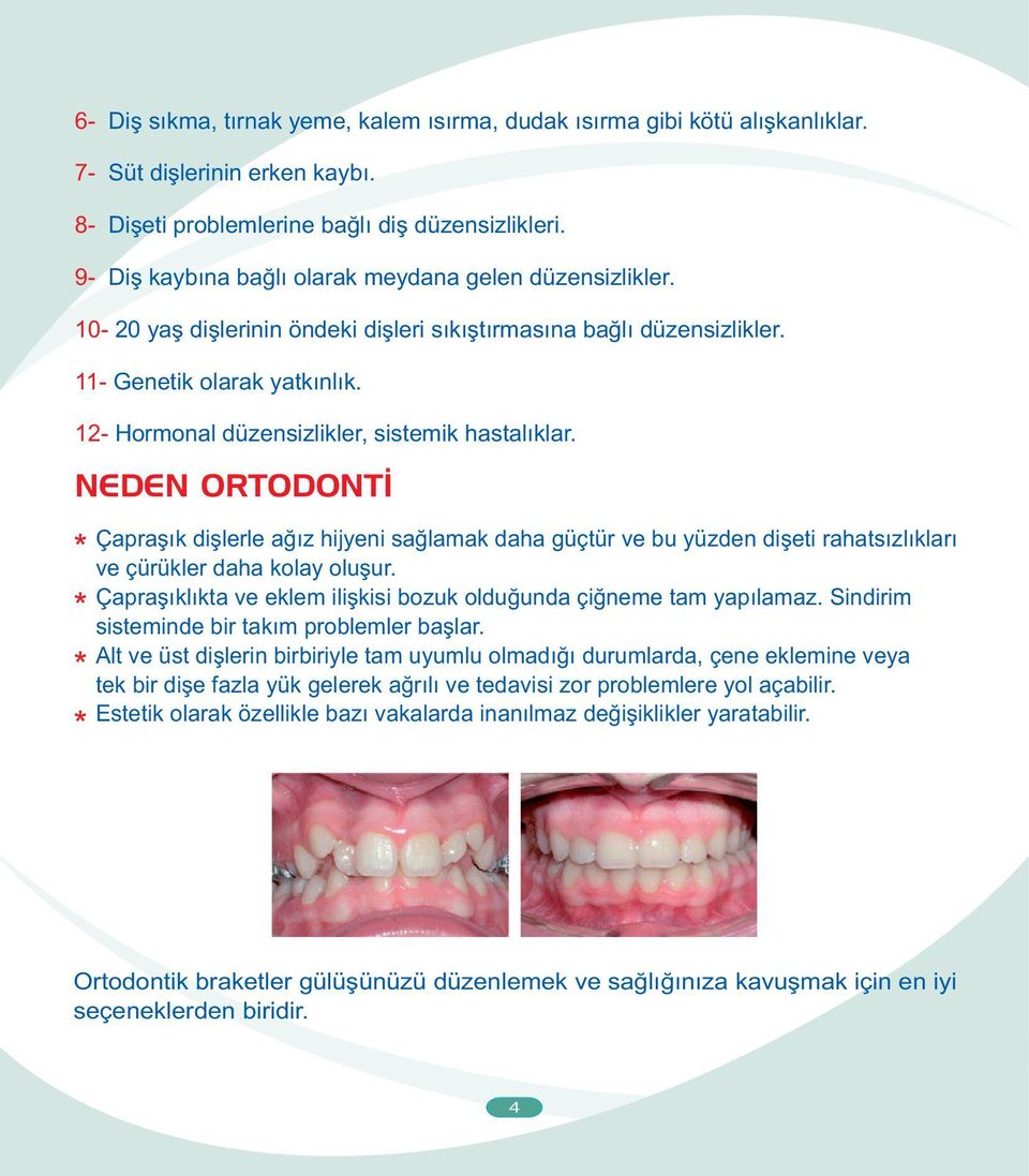 12- Hormonal düzensizlikler, sistemik hastalýklar. NEDEN ORTODONTÝ Çapraþýk diþlerle aðýz hijyeni saðlamak daha güçtür ve bu yüzden diþeti rahatsýzlýklarý ve çürükler daha kolay oluþur.