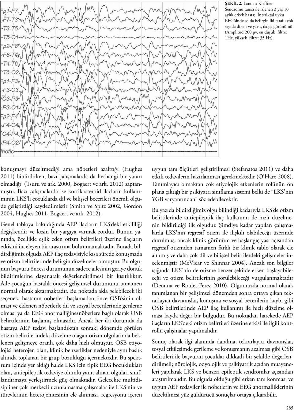 filtre: 1Hz, yüksek filtre: 35 Hz). konuşmayı düzeltmediği ama nöbetleri azalttığı (Hughes 2011) bildirilirken, bazı çalışmalarda da herhangi bir yararı olmadığı (Tsuru ve ark. 2000, Bogaert ve ark.