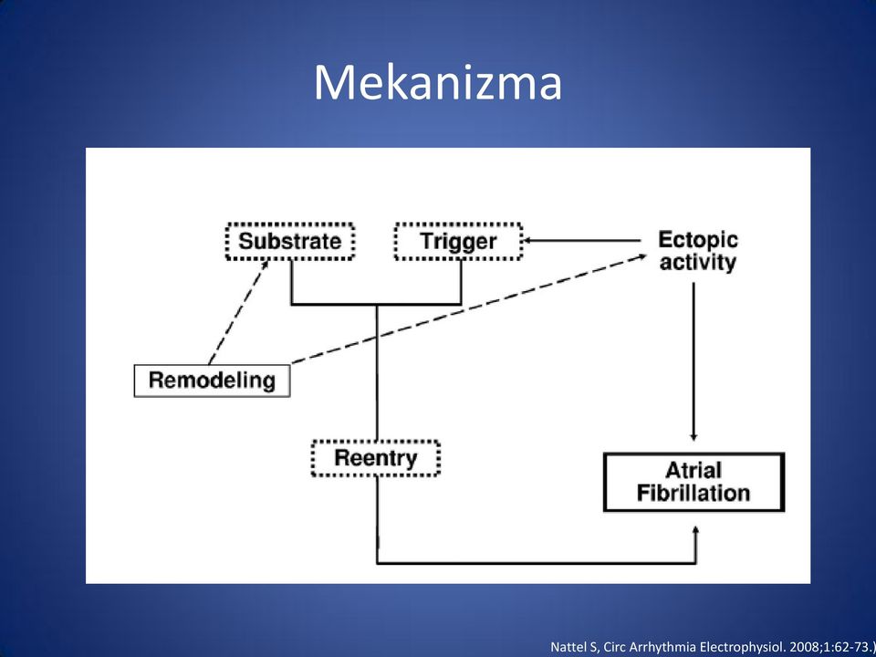 Arrhythmia