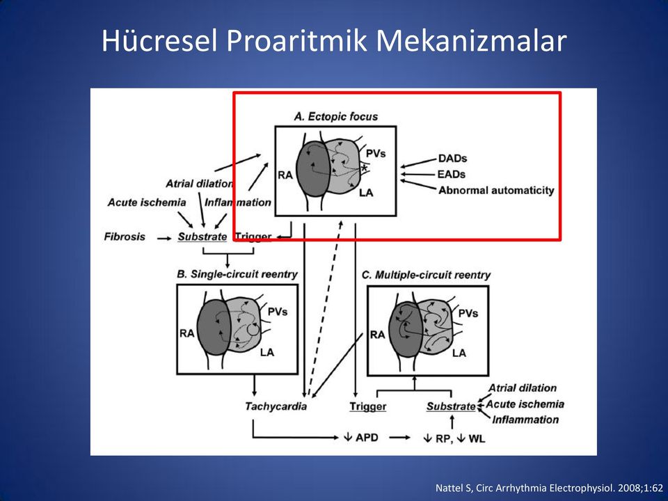 S, Circ Arrhythmia