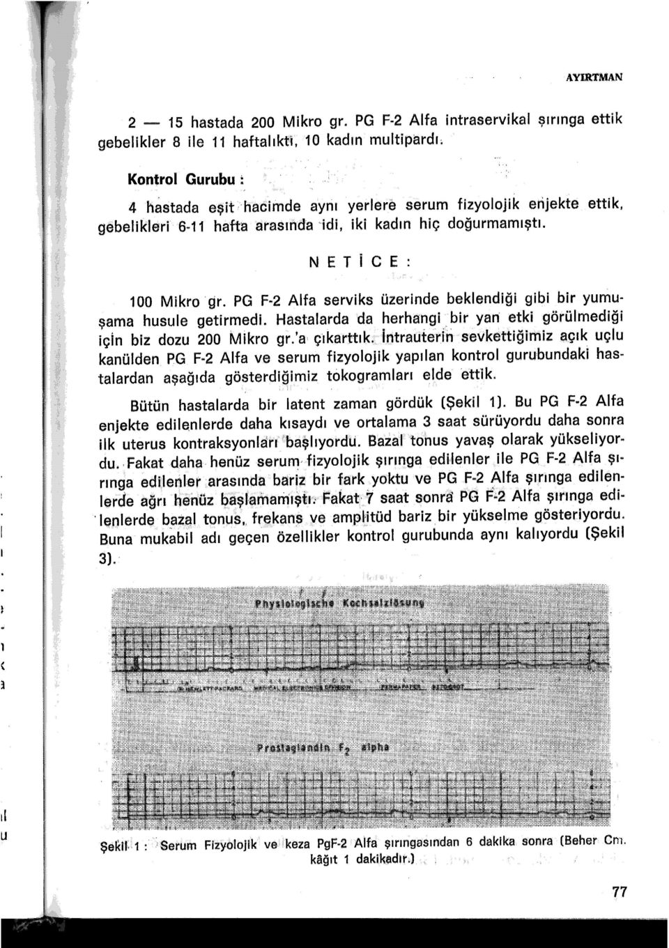 hafta arasında 'idi, iki kadın hiç doğurmamıştı. NETİCE: 100 Mikro 'gr. PG F-2 Alfa serviks üzerinde beklendiği gibi bir yumuşama husule getirmedi.