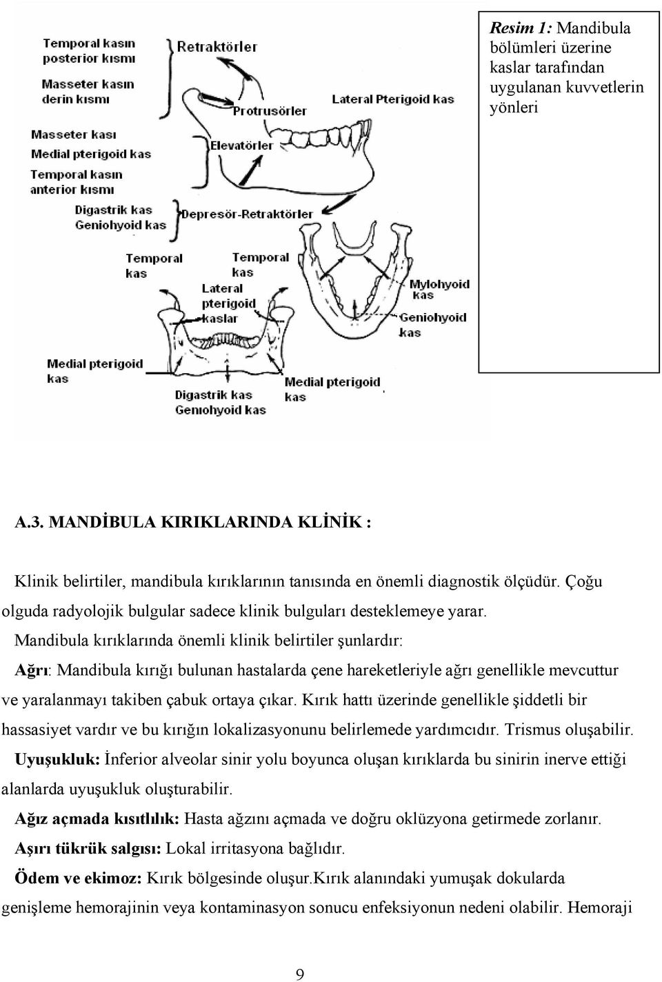 Mandibula kırıklarında önemli klinik belirtiler şunlardır: Ağrı: Mandibula kırığı bulunan hastalarda çene hareketleriyle ağrı genellikle mevcuttur ve yaralanmayı takiben çabuk ortaya çıkar.