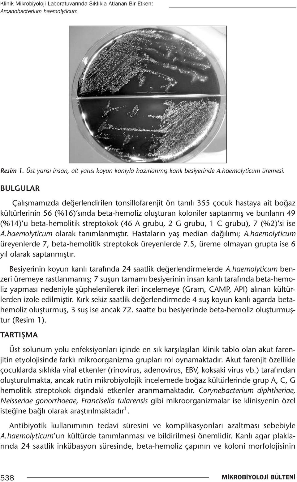 beta-hemolitik streptokok (46 A grubu, 2 G grubu, 1 C grubu), 7 (%2) si ise A.haemolyticum olarak tanımlanmıştır. Hastaların yaş median dağılımı; A.