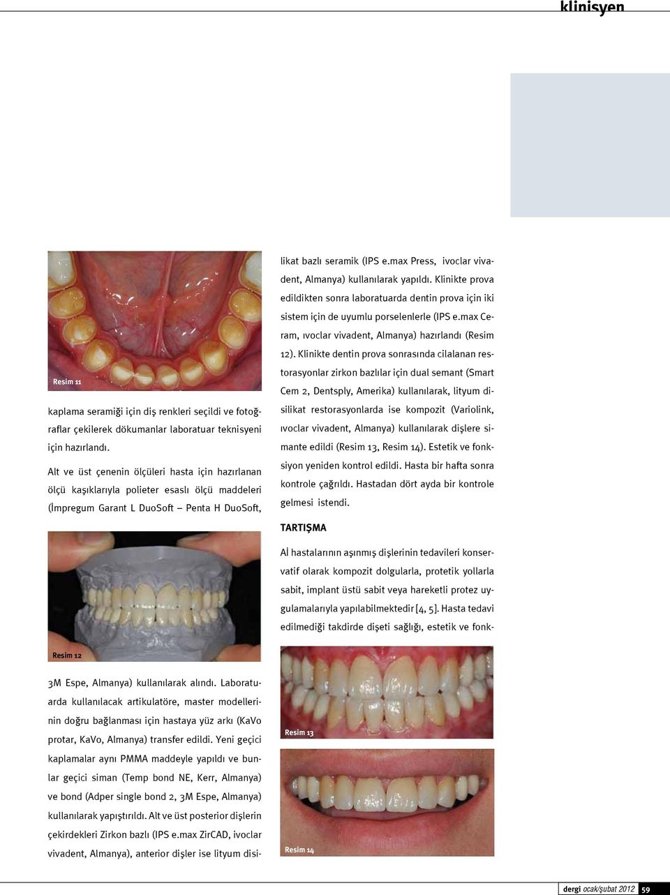 max Press, ivoclar vivadent, Almanya) kullanılarak yapıldı. Klinikte prova edildikten sonra laboratuarda dentin prova için iki sistem için de uyumlu porselenlerle (IPS e.