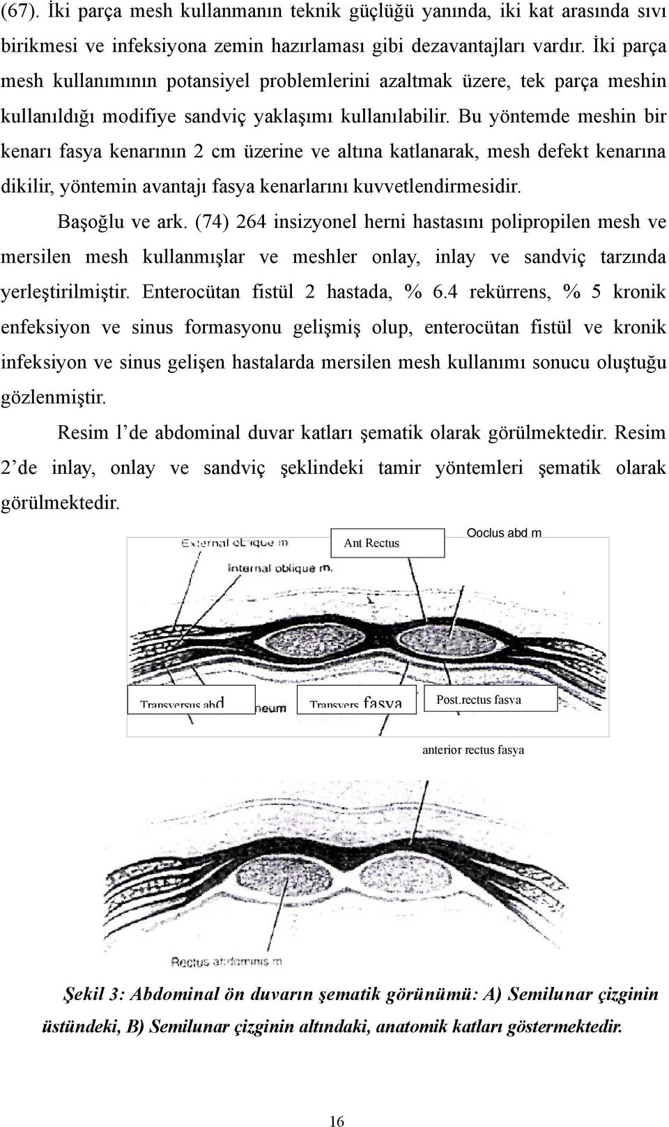 Bu yöntemde meshin bir kenarı fasya kenarının 2 cm üzerine ve altına katlanarak, mesh defekt kenarına dikilir, yöntemin avantajı fasya kenarlarını kuvvetlendirmesidir. Başoğlu ve ark.