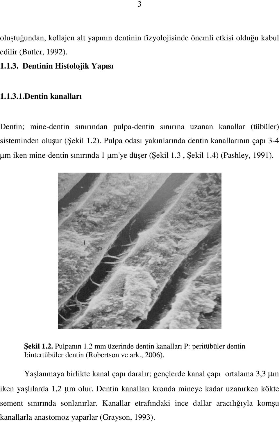 3, Şekil 1.4) (Pashley, 1991). Şekil 1.2. Pulpanın 1.2 mm üzerinde dentin kanalları P: peritübüler dentin I:intertübüler dentin (Robertson ve ark., 2006).