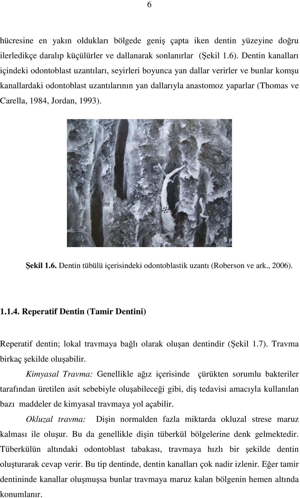 1984, Jordan, 1993). Şekil 1.6. Dentin tübülü içerisindeki odontoblastik uzantı (Roberson ve ark., 2006). 1.1.4. Reperatif Dentin (Tamir Dentini) Reperatif dentin; lokal travmaya bağlı olarak oluşan dentindir (Şekil 1.