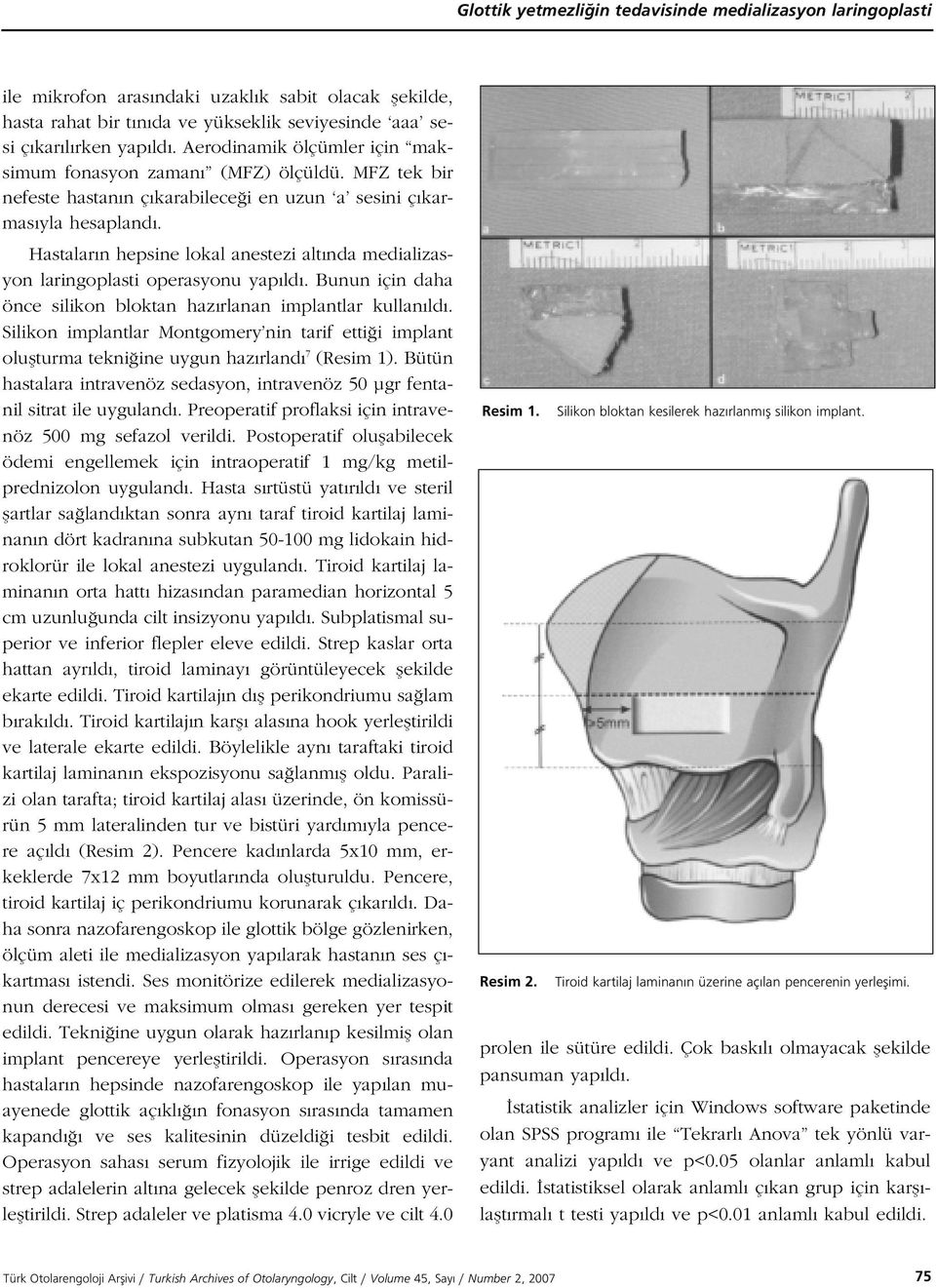 Hastalar n hepsine lokal anestezi alt nda medializasyon laringoplasti operasyonu yap ld. Bunun için daha önce silikon bloktan haz rlanan implantlar kullan ld.