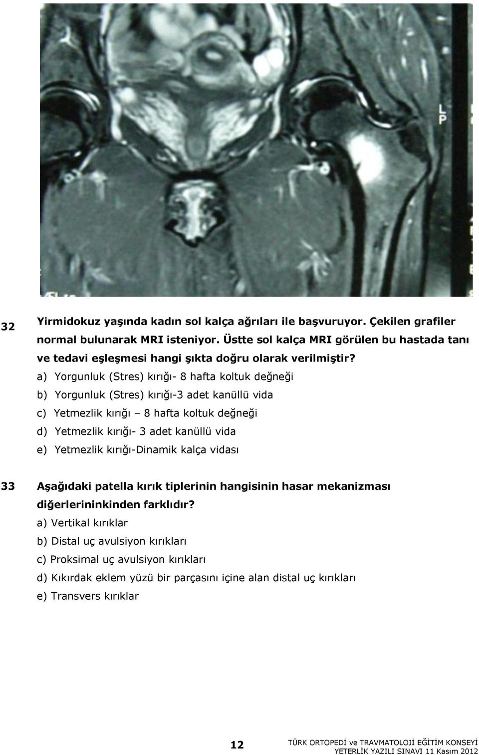 a) Yorgunluk (Stres) kırığı- 8 hafta koltuk değneği b) Yorgunluk (Stres) kırığı-3 adet kanüllü vida c) Yetmezlik kırığı 8 hafta koltuk değneği d) Yetmezlik kırığı- 3 adet kanüllü