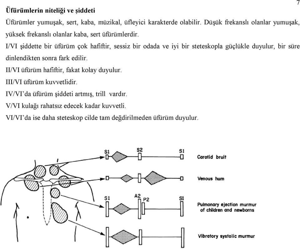 I/VI şiddette bir üfürüm çok hafiftir, sessiz bir odada ve iyi bir steteskopla güçlükle duyulur, bir süre dinlendikten sonra fark edilir.