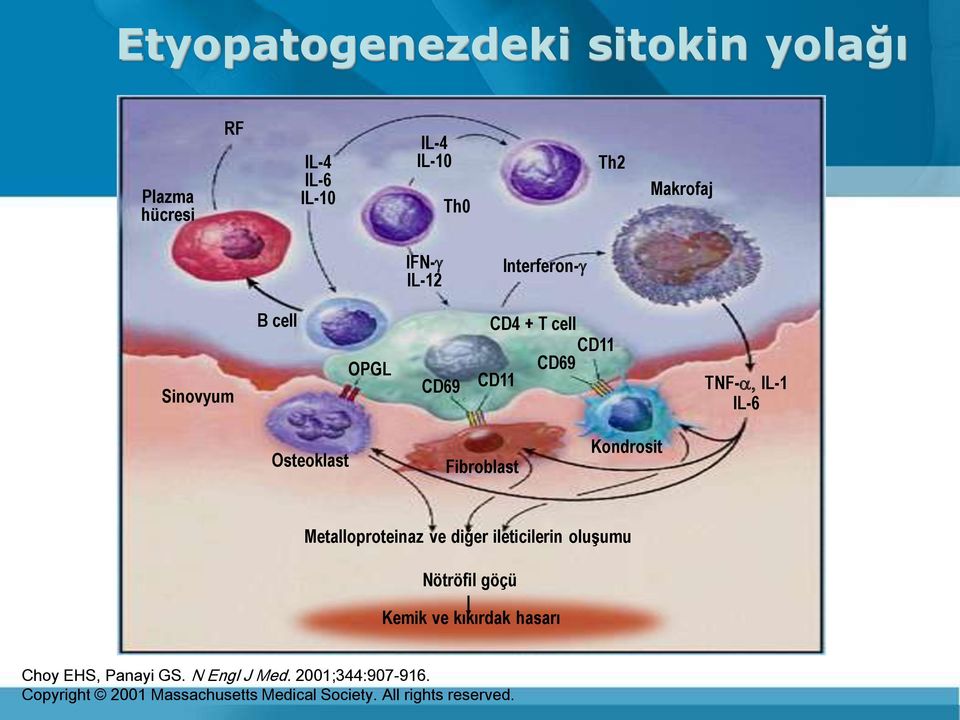 Kondrosit Metalloproteinaz ve diğer ileticilerin oluşumu Nötröfil göçü Kemik ve kıkırdak hasarı Choy EHS,