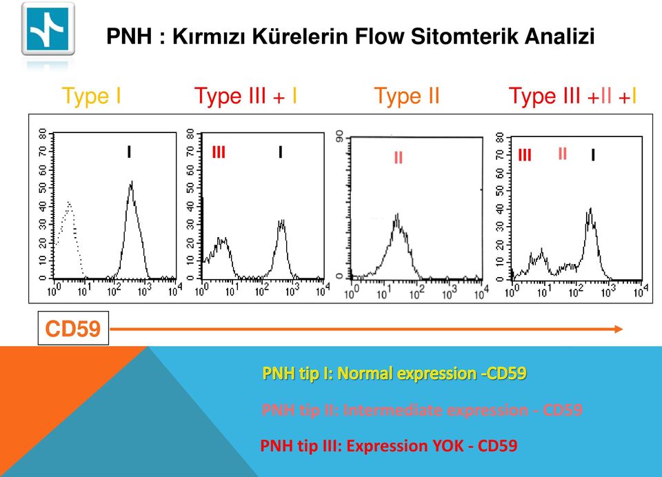 I II III II I Counts CD59 PNH tip II: Intermediate