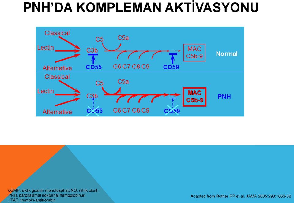 noktürnal hemoglobinüri ; TAT,