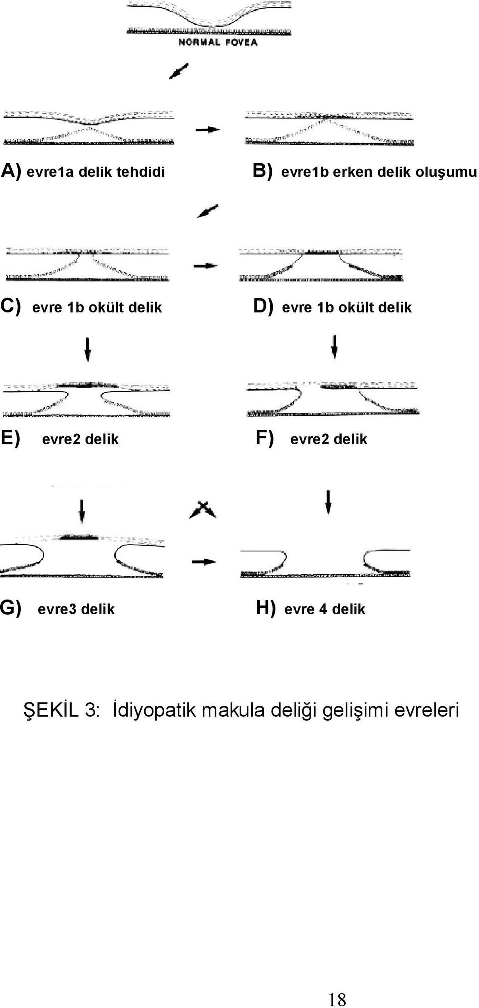 evre2 delik F) evre2 delik G) evre3 delik H) evre 4