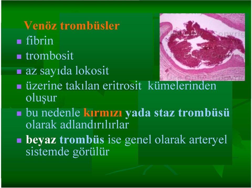 nedenle kırmızı yada staz trombüsü olarak