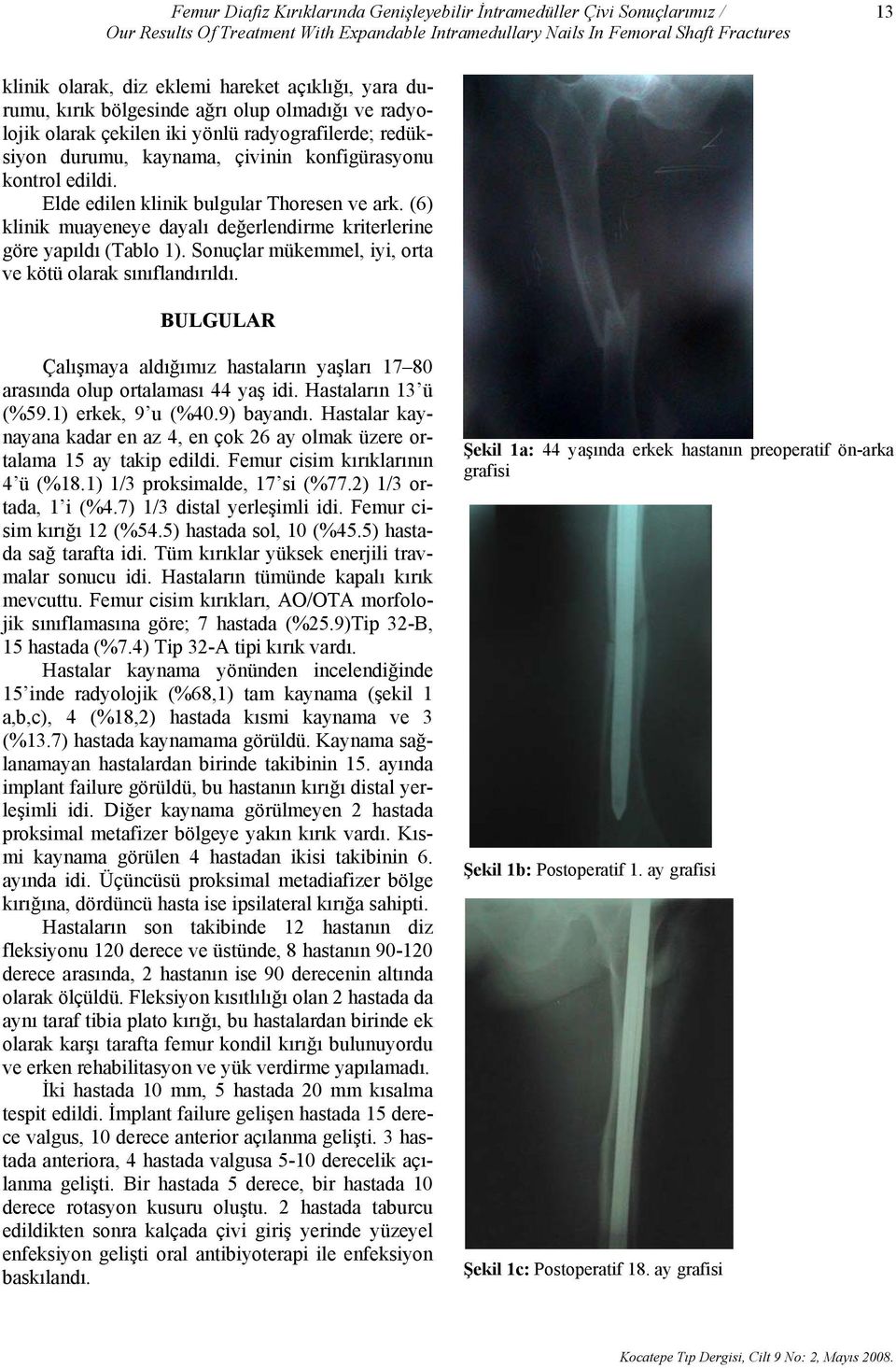 Elde edilen klinik bulgular Thoresen ve ark. (6) klinik muayeneye dayalı değerlendirme kriterlerine göre yapıldı (Tablo 1). Sonuçlar mükemmel, iyi, orta ve kötü olarak sınıflandırıldı.