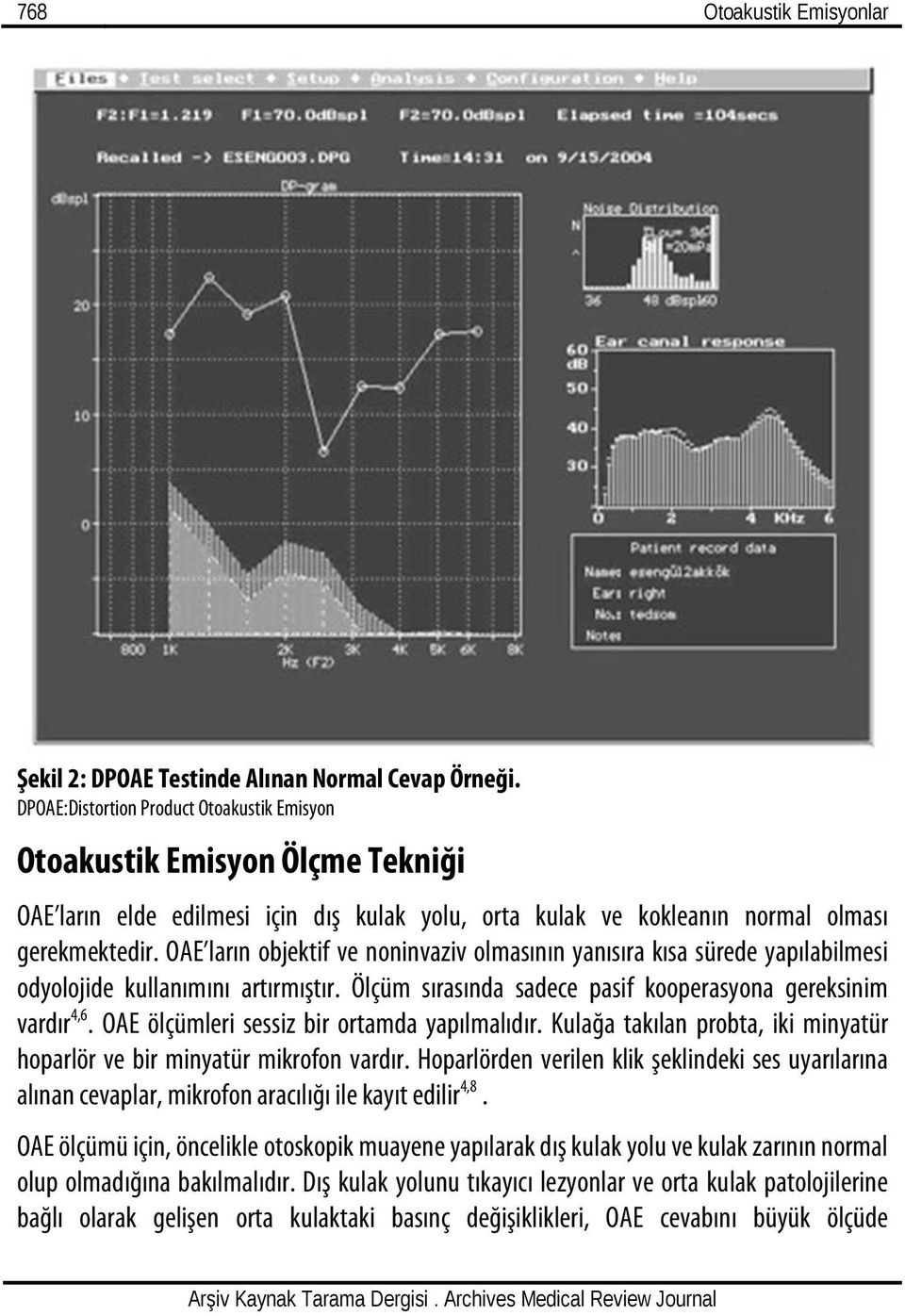 OAE ların objektif ve noninvaziv olmasının yanısıra kısa sürede yapılabilmesi odyolojide kullanımını artırmıştır. Ölçüm sırasında sadece pasif kooperasyona gereksinim vardır 4,6.