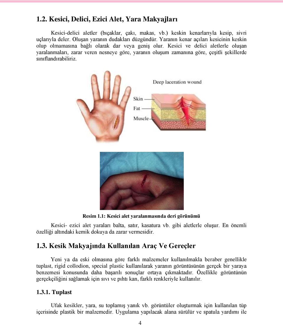 Kesici ve delici aletlerle oluşan yaralanmaları, zarar veren nesneye göre, yaranın oluşum zamanına göre, çeşitli şekillerde sınıflandırabiliriz. Resim 1.