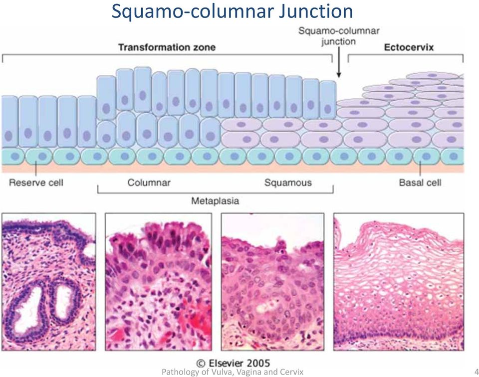 Pathology of