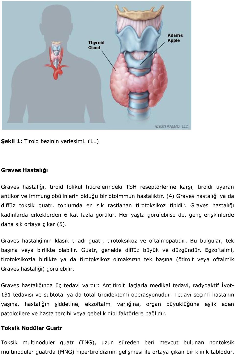 (4) Graves hastalığı ya da diffüz toksik guatr, toplumda en sık rastlanan tirotoksikoz tipidir. Graves hastalığı kadınlarda erkeklerden 6 kat fazla görülür.