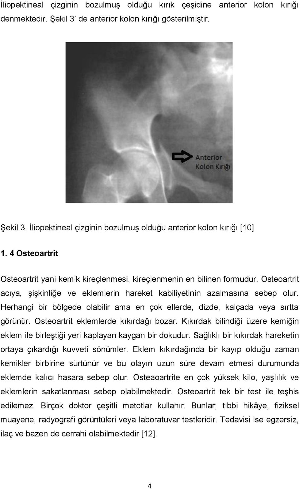 Herhangi bir bölgede olabilir ama en çok ellerde, dizde, kalçada veya sırtta görünür. Osteoartrit eklemlerde kıkırdağı bozar.