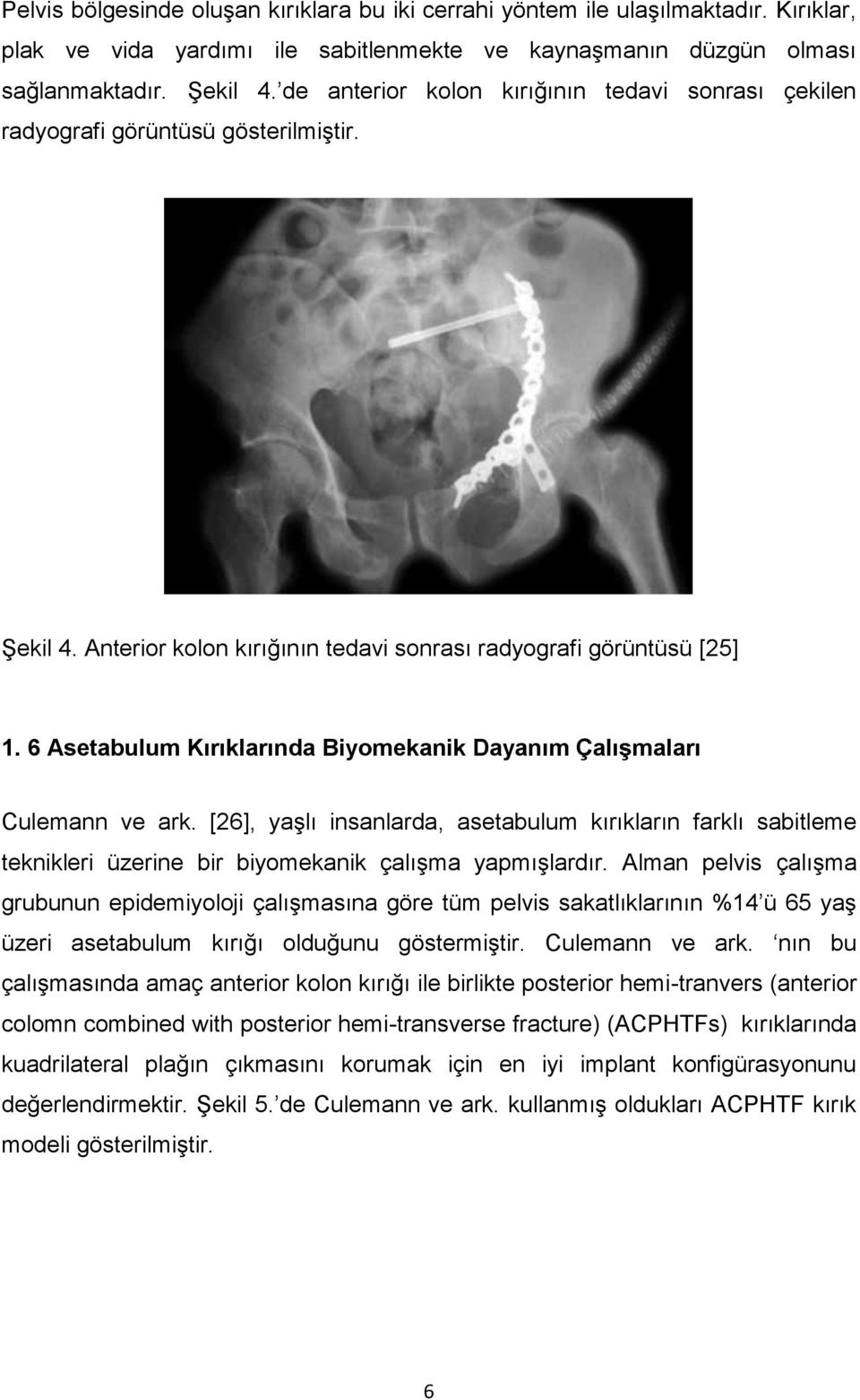 6 Asetabulum Kırıklarında Biyomekanik Dayanım Çalışmaları Culemann ve ark. [26], yaşlı insanlarda, asetabulum kırıkların farklı sabitleme teknikleri üzerine bir biyomekanik çalışma yapmışlardır.