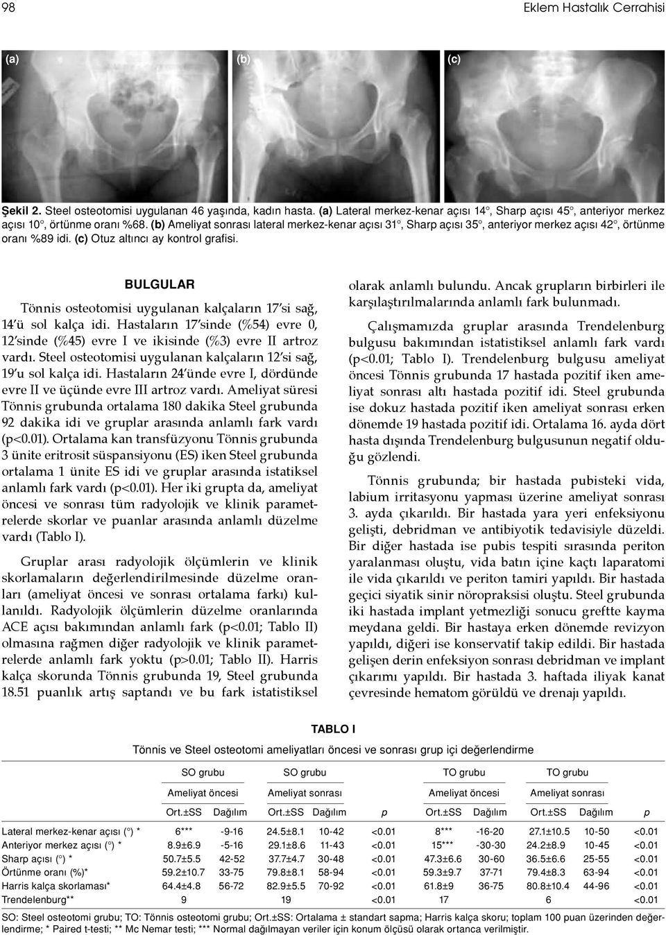 BULGULAR Tönnis osteotomisi uygulanan kalçaların 17 si sağ, 14 ü sol kalça idi. Hastaların 17 sinde (%54) evre 0, 12 sinde (%45) evre I ve ikisinde (%3) evre II artroz vardı.