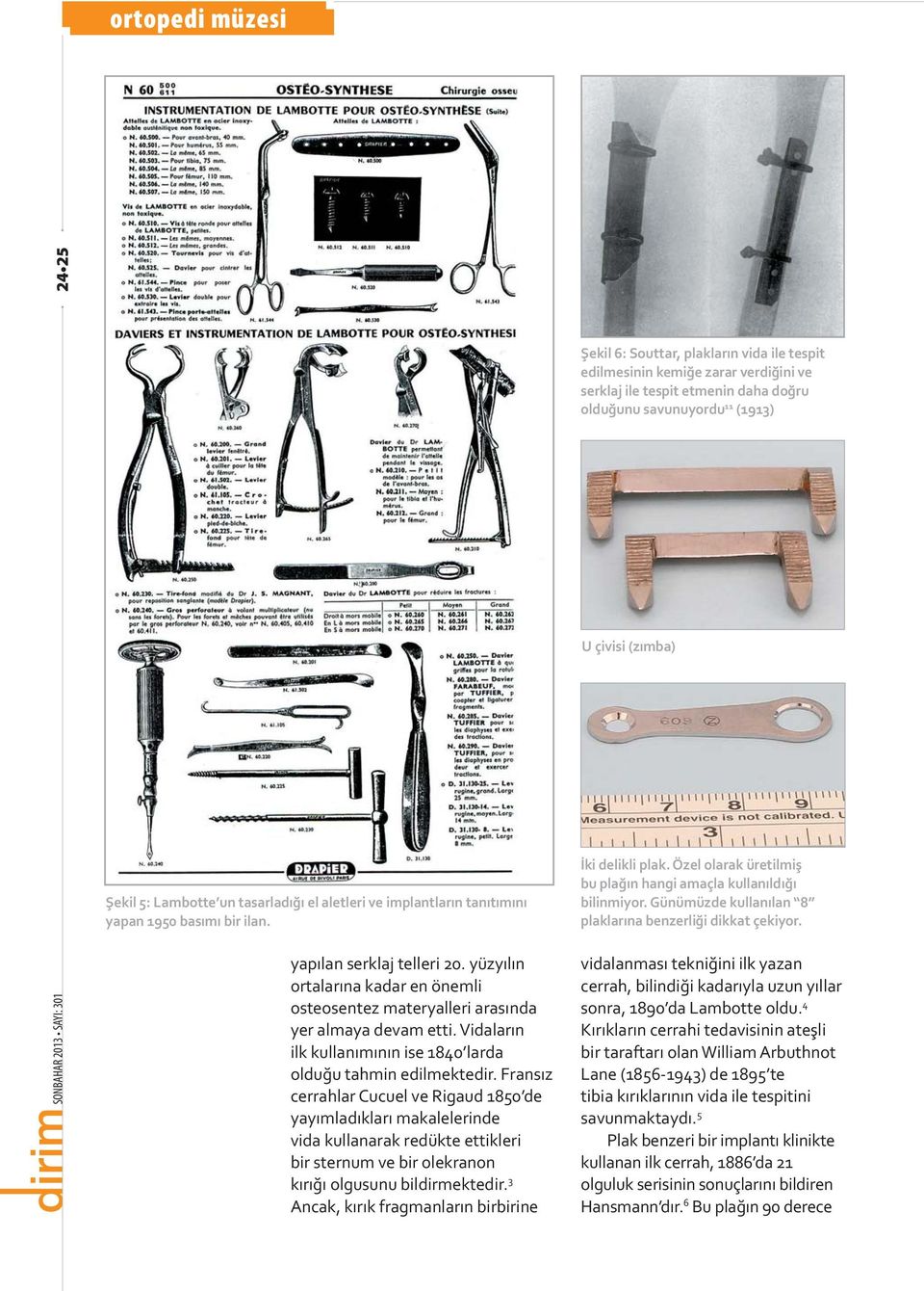 Frans z cerrahlar Cucuel ve Rigaud 1850 de yay mlad klar makalelerinde vida kullanarak redükte ettikleri bir sternum ve bir olekranon k r olgusunu bildirmektedir.