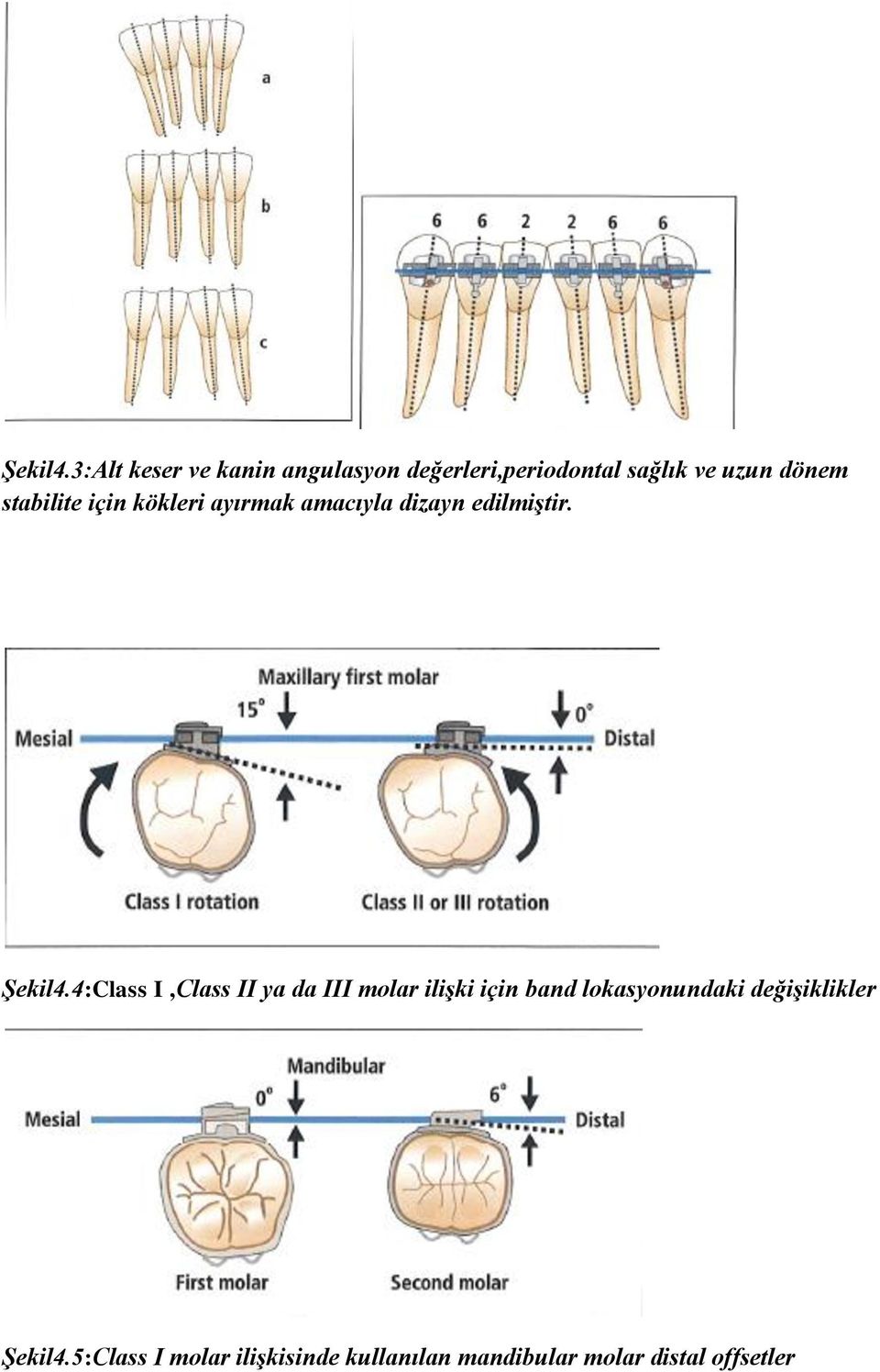 stabilite için kökleri ayırmak amacıyla dizayn edilmiştir.