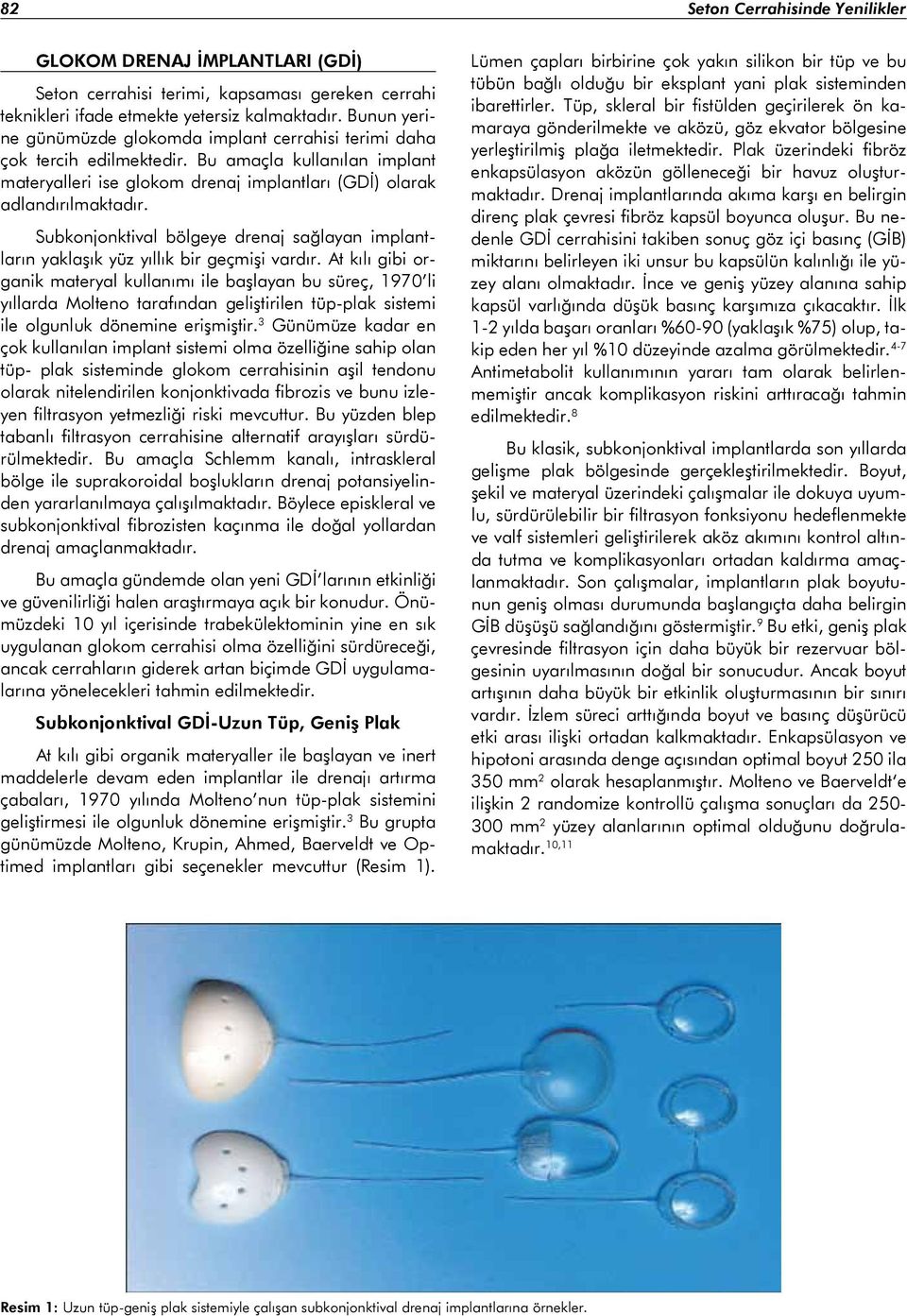 Subkonjonktival bölgeye drenaj sağlayan implantların yaklaşık yüz yıllık bir geçmişi vardır.