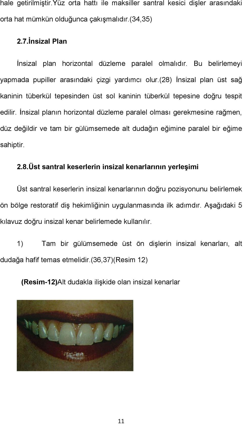 İnsizal planın horizontal düzleme paralel olması gerekmesine rağmen, düz değildir ve tam bir gülümsemede alt dudağın eğimine paralel bir eğime sahiptir. 2.8.