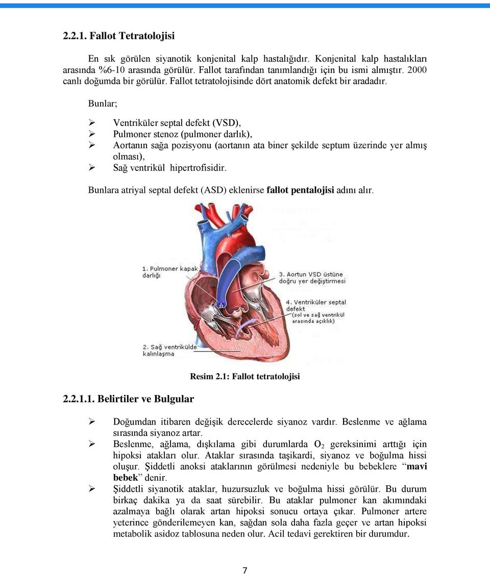 Bunlar; Ventriküler septal defekt (VSD), Pulmoner stenoz (pulmoner darlık), Aortanın sağa pozisyonu (aortanın ata biner şekilde septum üzerinde yer almış olması), Sağ ventrikül hipertrofisidir.